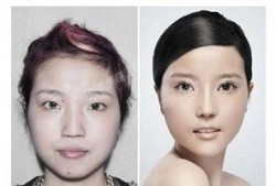 成都医疗整形爆料事件最新,揭秘行业乱象，患者权益如何保障？